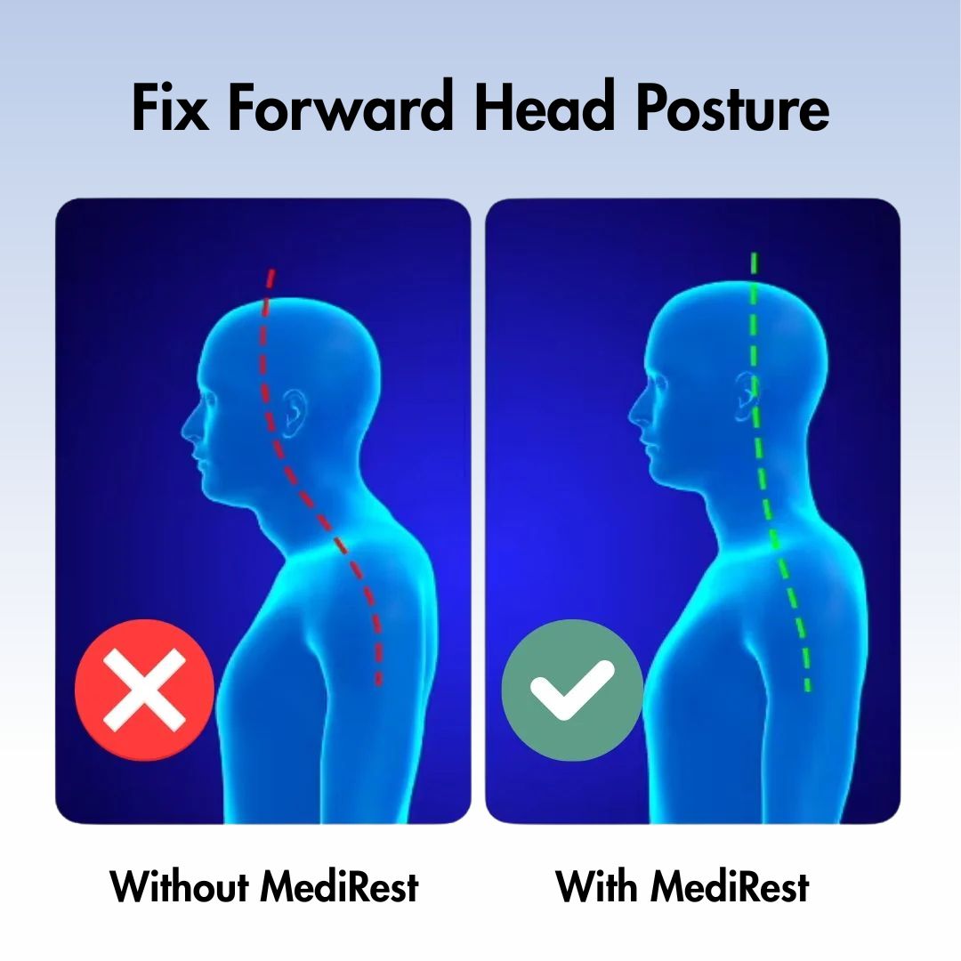 NeckRelieve™